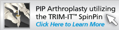 PIP Arthroplasty utilizing the TRIM-IT SpinPin